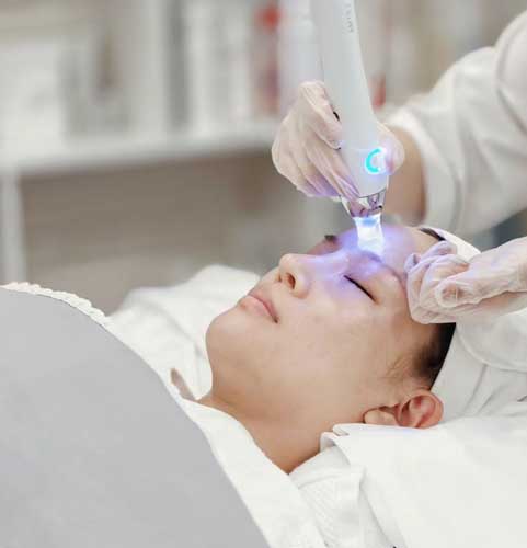 Microneedling at Healme - Australia